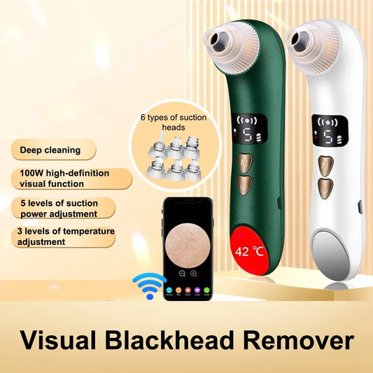 Smart Visual Blackhead Remover – 5 Suction Levels | Heat Therapy | HD Camera